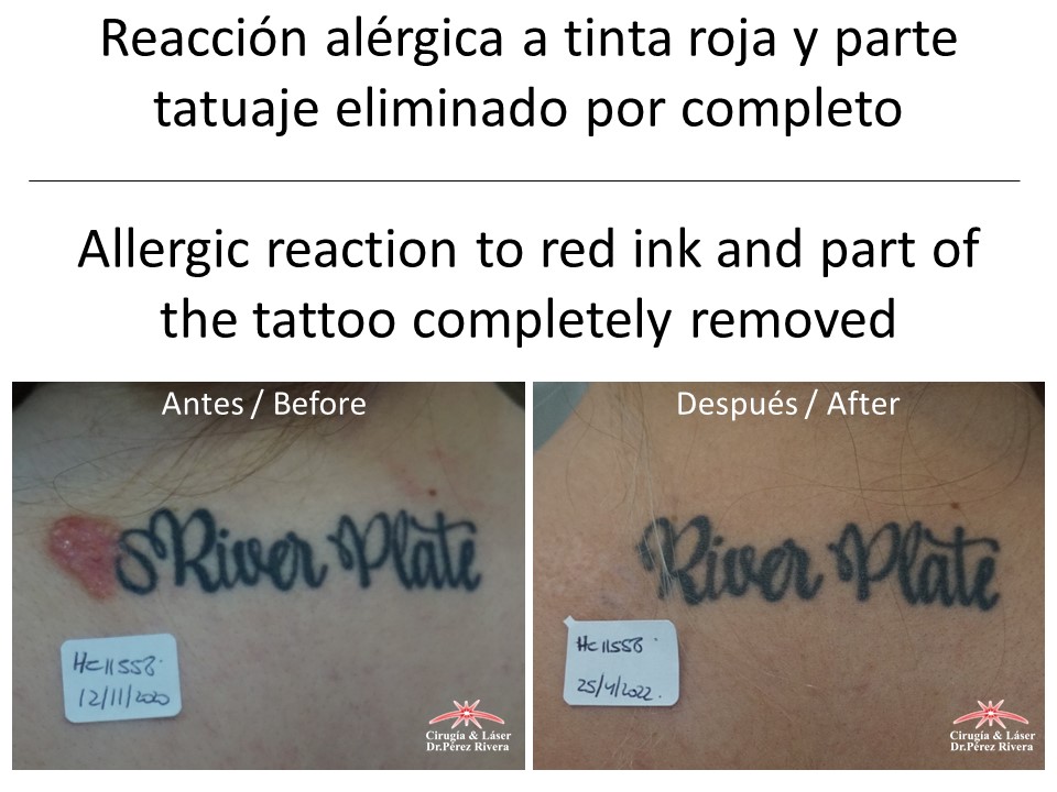 Antes y después