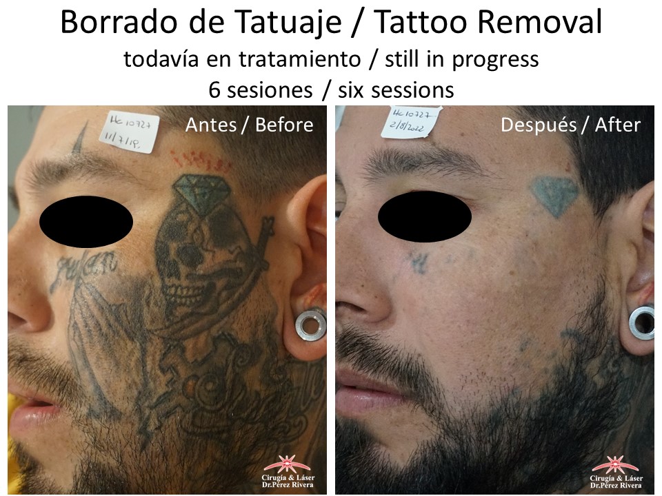 Antes y después